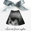 Dooky Sonogram Echo Frame